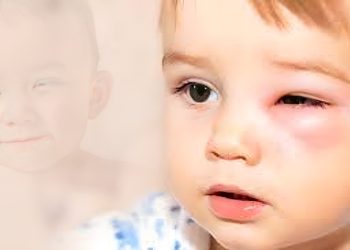 গরমে শিশুর চোখ ভাল রাখতে কী করবেন?